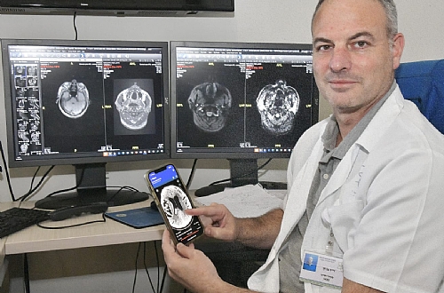 אפליקציה חדשה המשלבת בינה מלאכותית הביאה להצלת חיי מטופל במרכז הרפואי לגליל